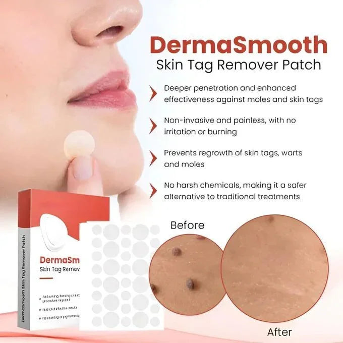 DERMA SMOOTH® SKIN TAG REMOVER PATCH