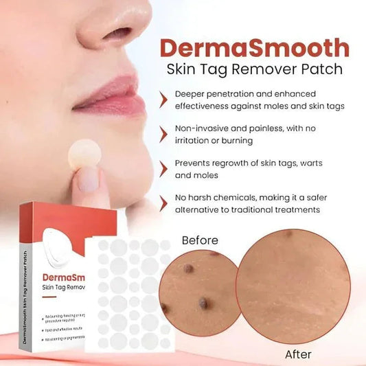 DERMA SMOOTH® SKIN TAG REMOVER PATCH