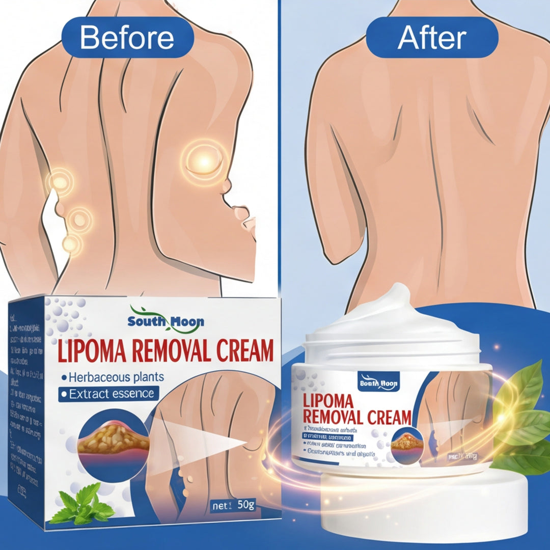 South Moon Lipoma Removal Cream || SUMMER FLASH SALE
